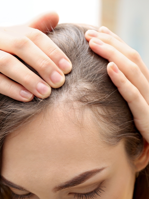 Trattamento malattie del cuoio capelluto Montecosaro Scalo